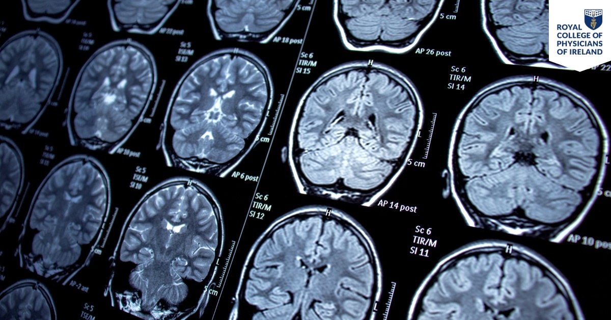 Hubspot Fellowship Landing Page Images (26)